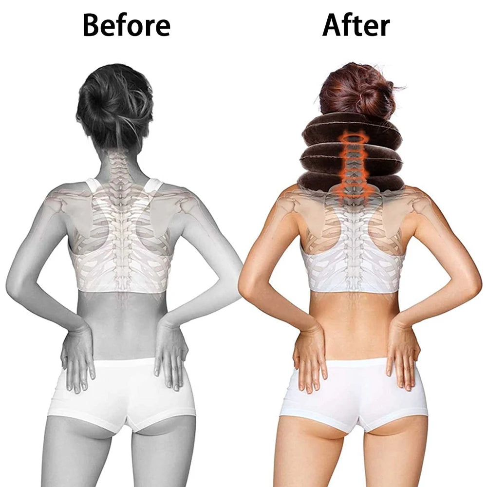 Cervical Neck Traction Device